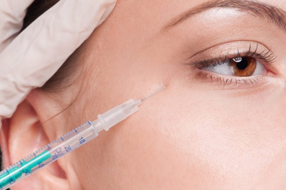 temples botox injecion