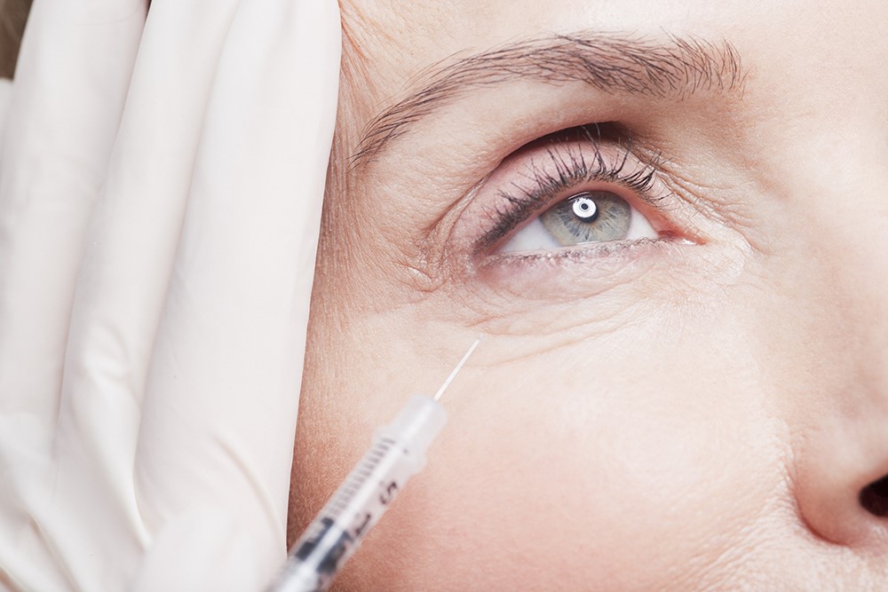 botox injection under the eyes