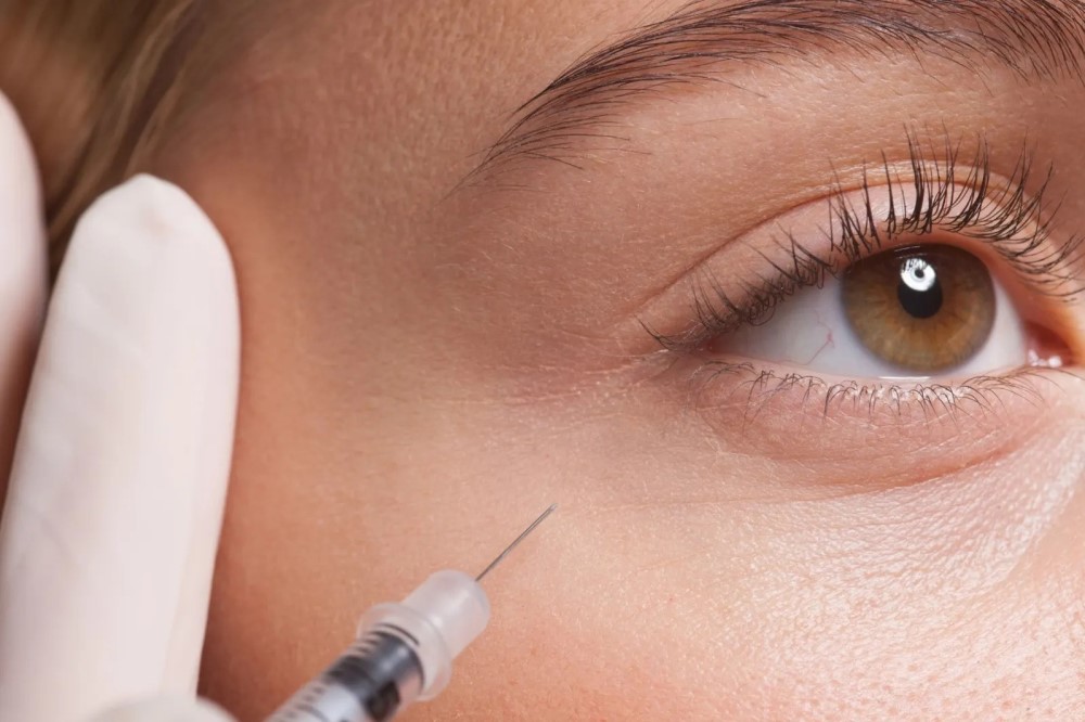 botox injection under the eyes