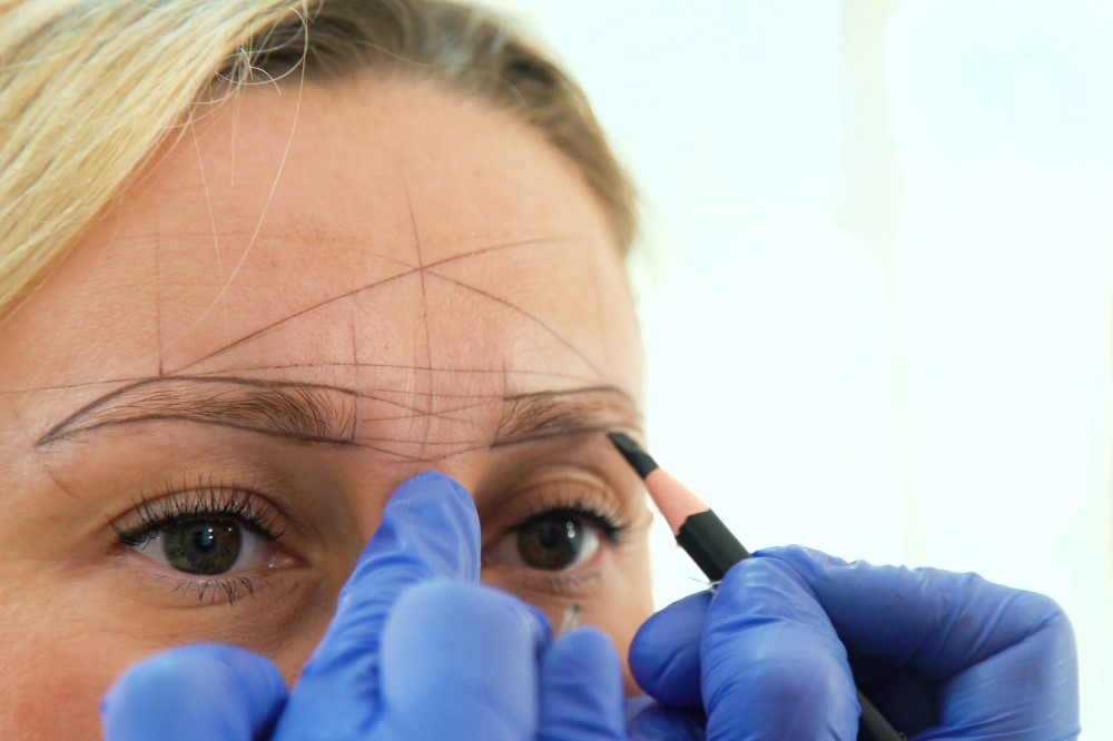 eyebrow transplant