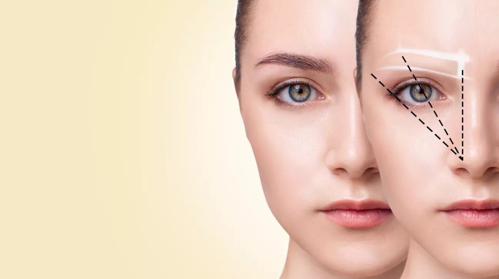 eyebrow transplant