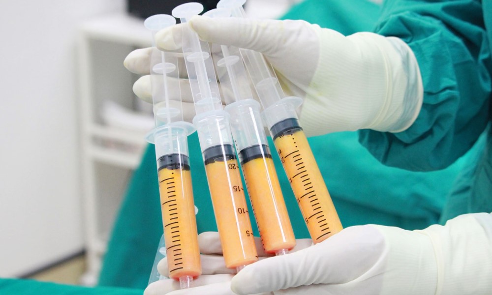 fat injection