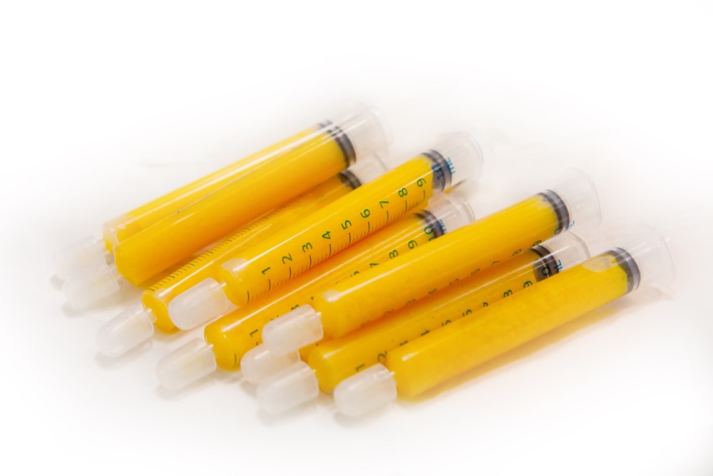 fat injection