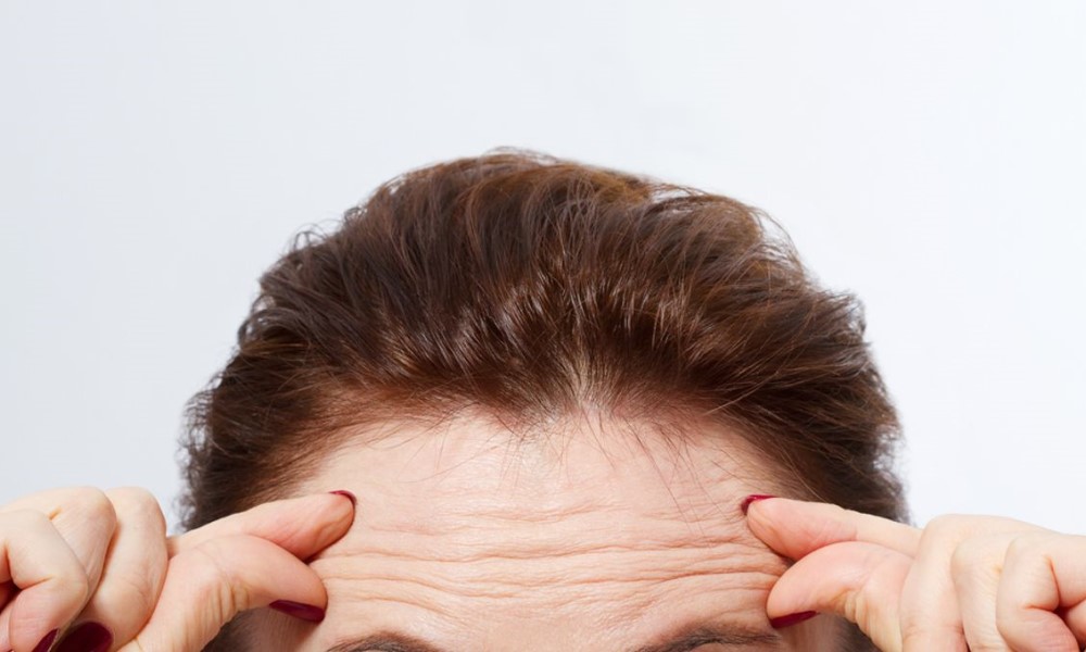 forehead wrinkles