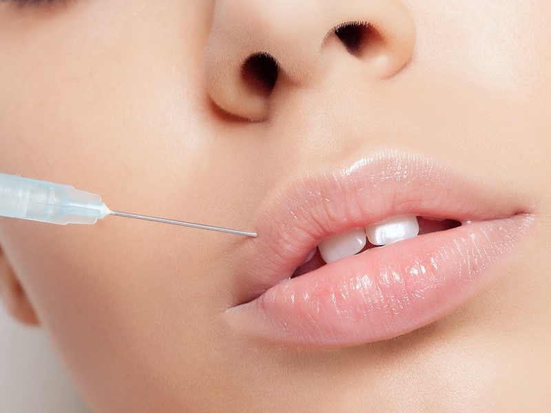 lip botox