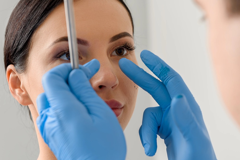 nose surgery