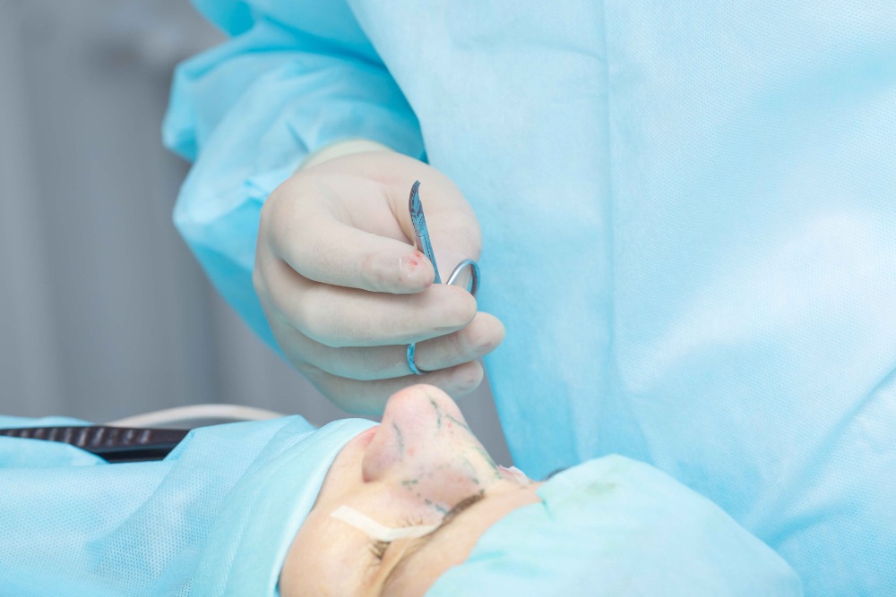 nose surgery