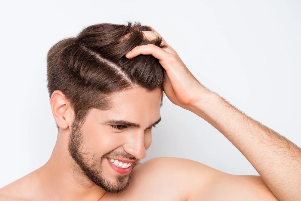 hair transplant
