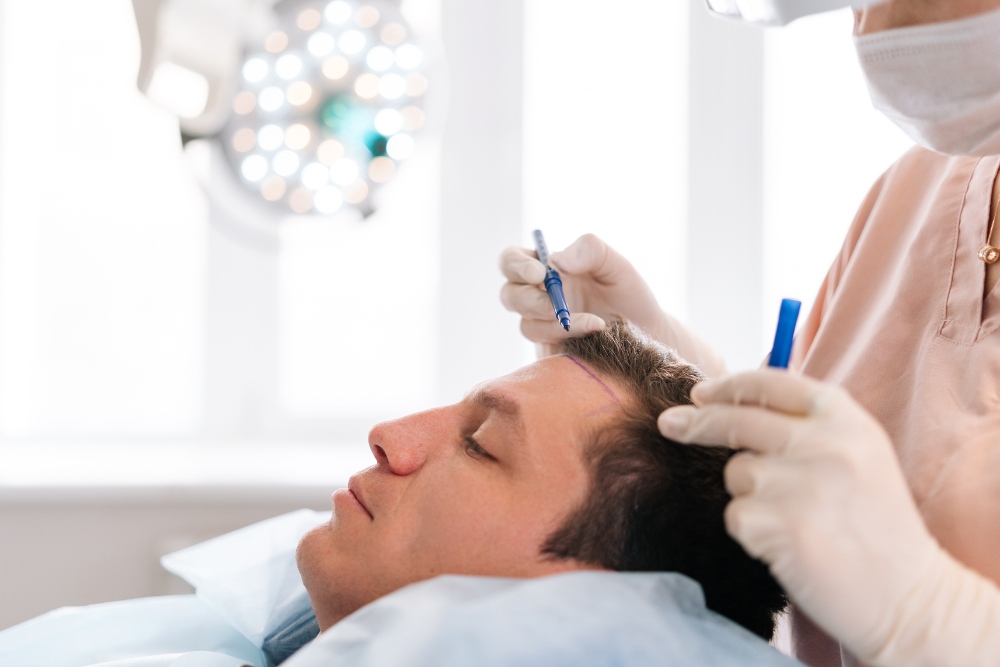 Best Age for Hair Transplant