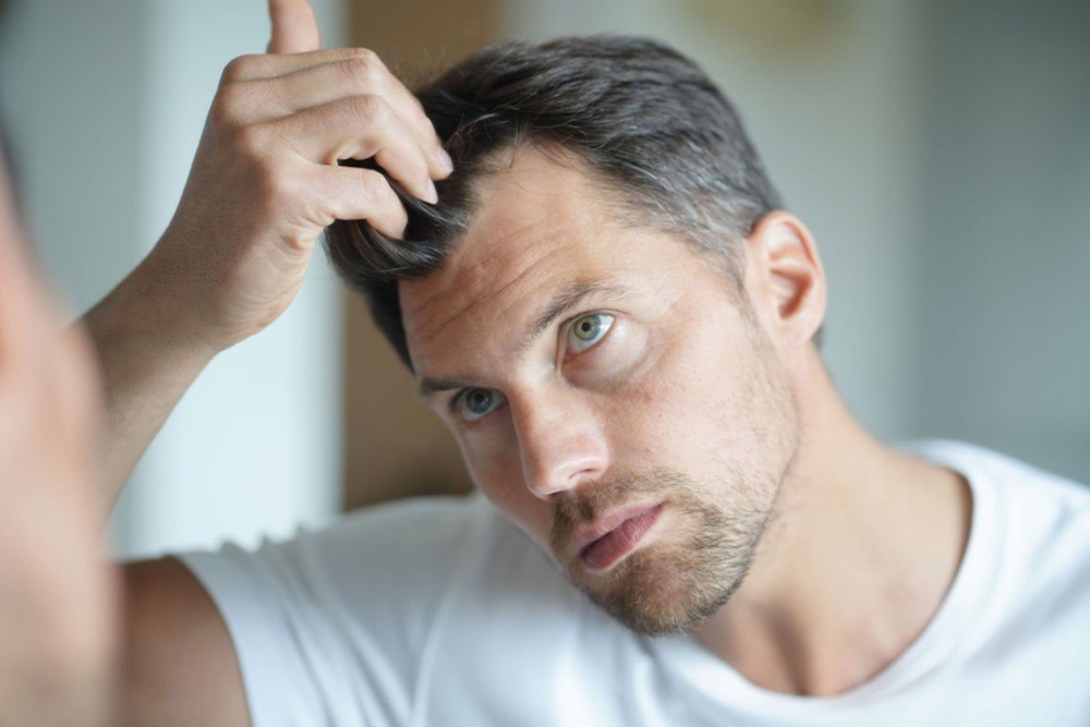 Best Age for Hair Transplant