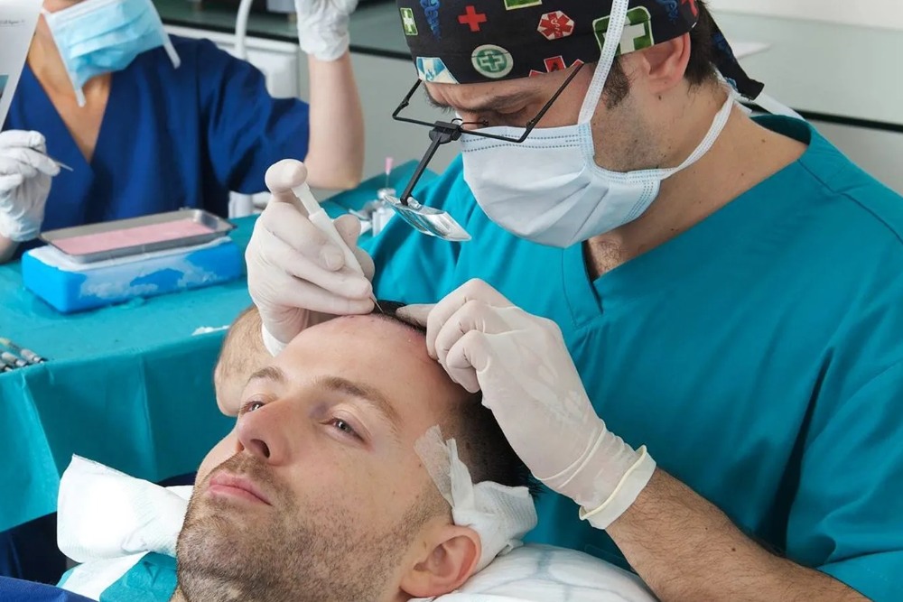 Complete Description of Hair Transplantation Stages