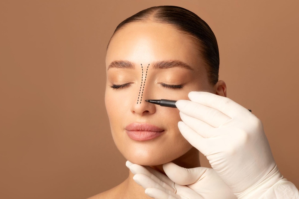 Nose surgery