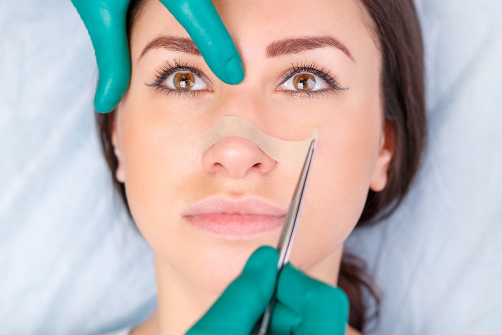 Nose surgery
