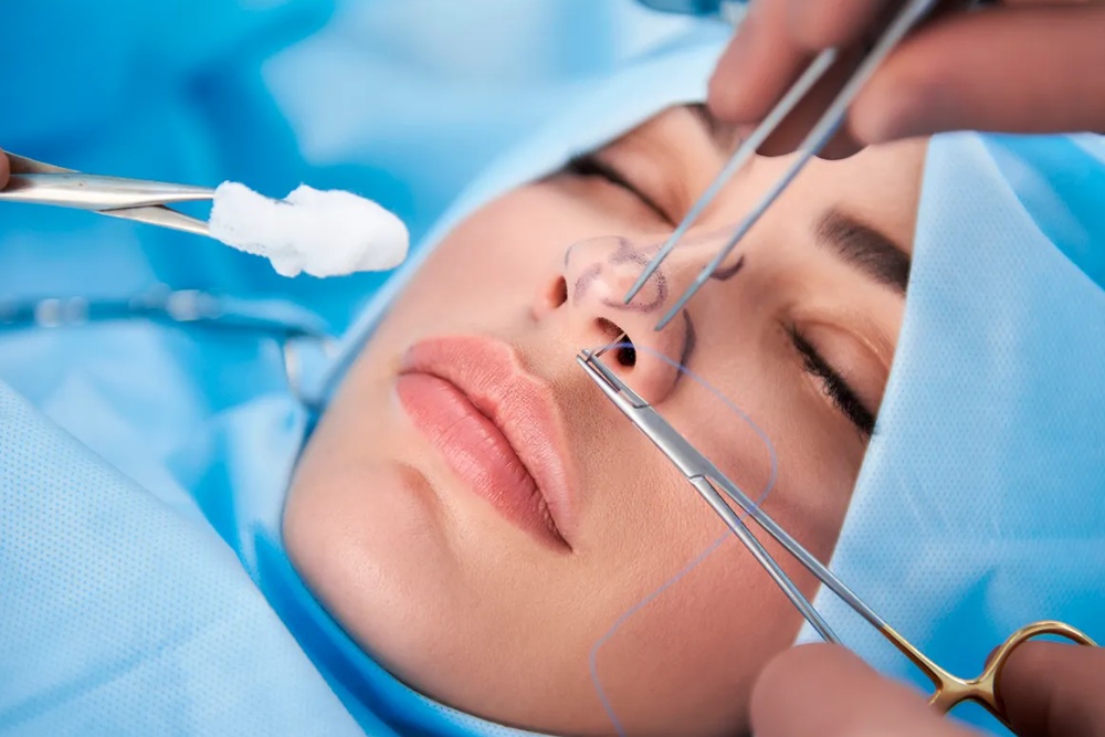 Nose surgery
