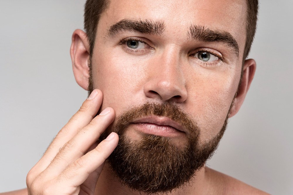 beard transplant