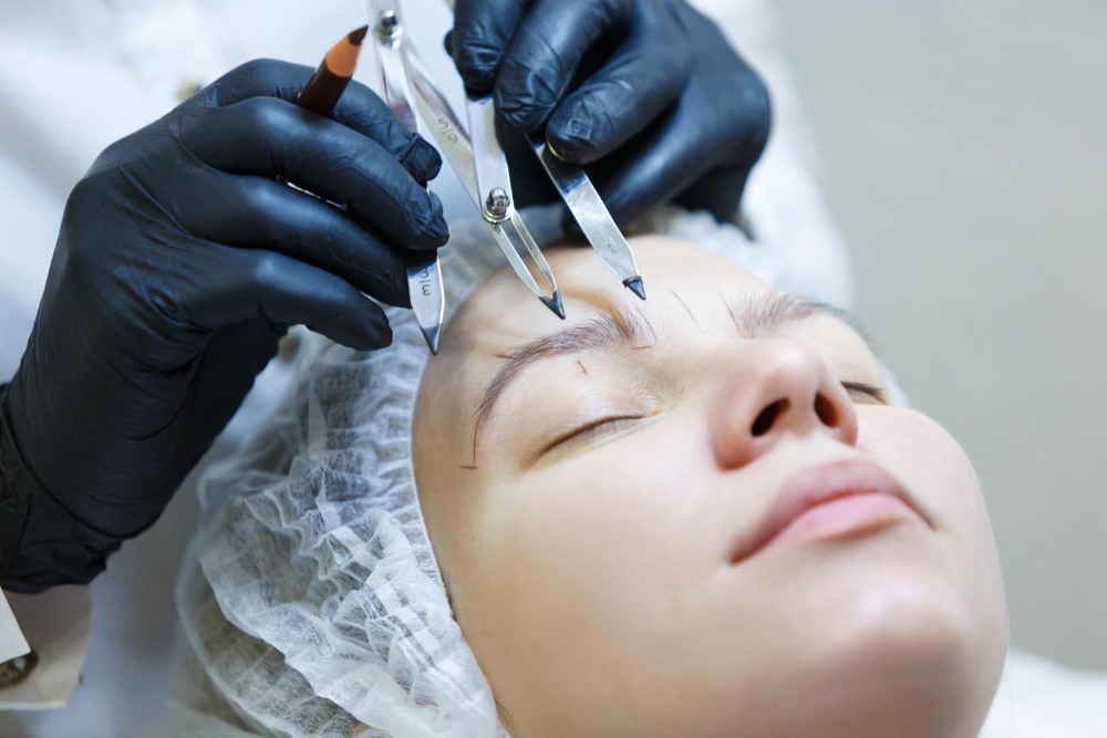 Eyebrow transplant
