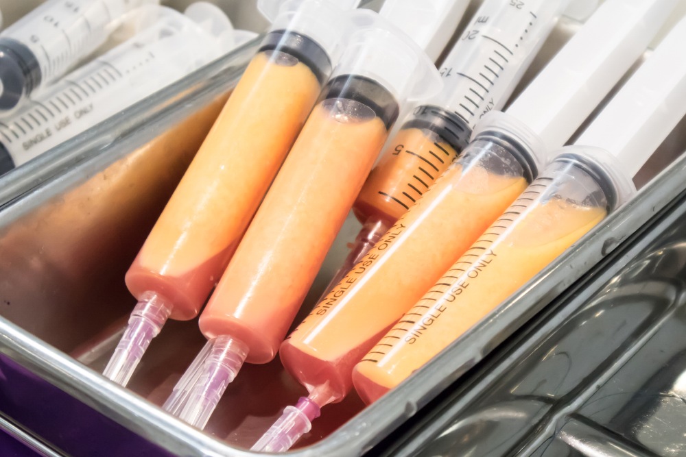 Fat Injection