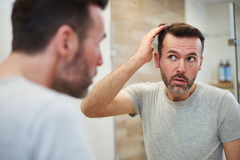 hair transplant